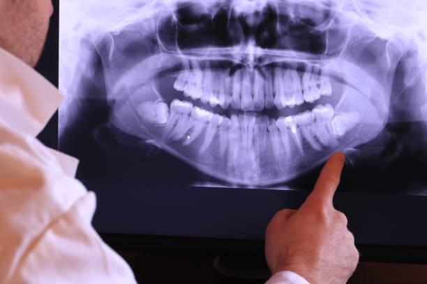 Urgent Tooth Repair in DE