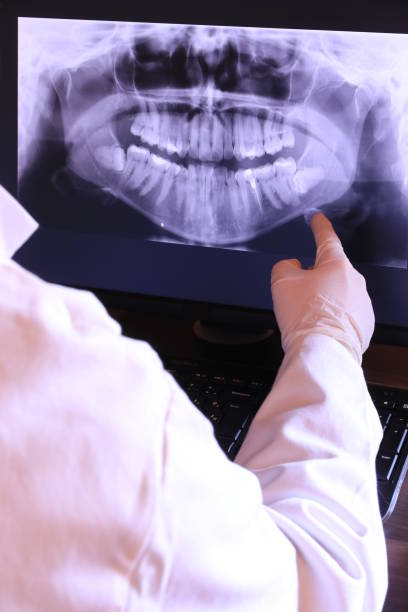 Tooth Infection Emergency Dentist in DE